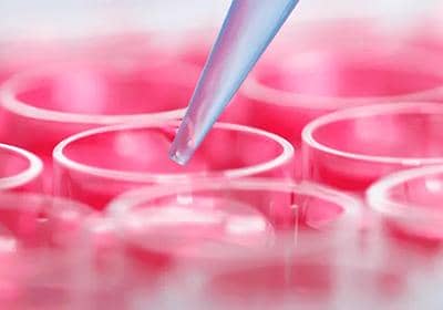 構(gòu)建穩(wěn)定細(xì)胞株時(shí)的常見問題有哪些?