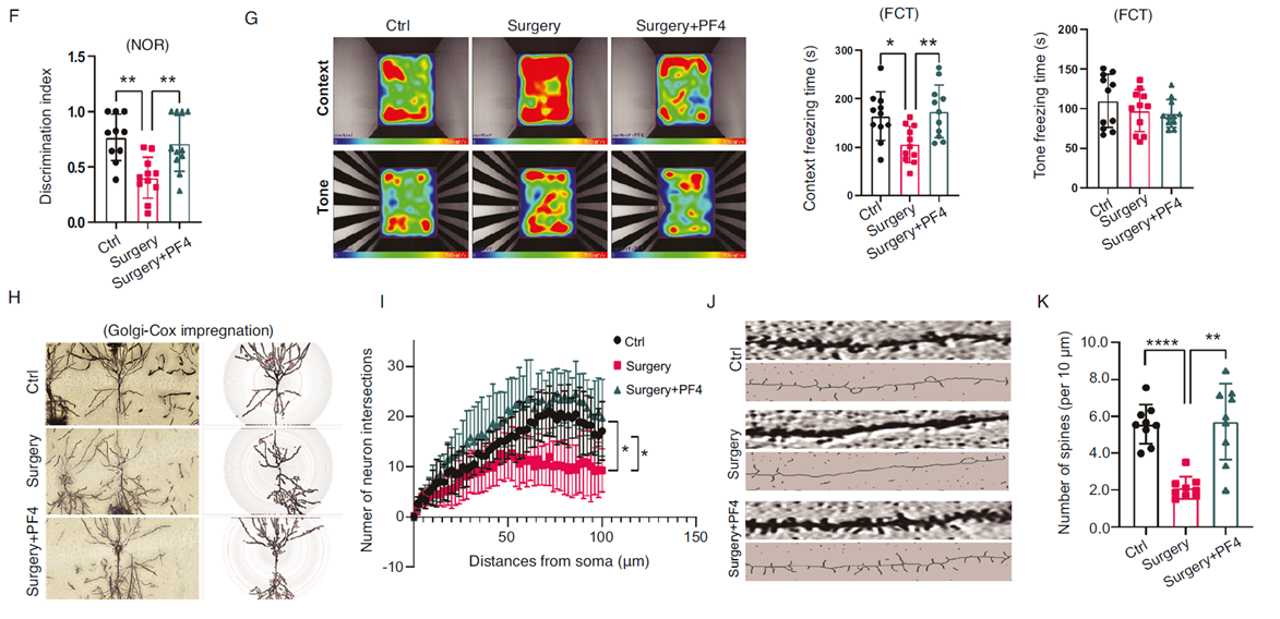PF4可改善并修復認知功能
