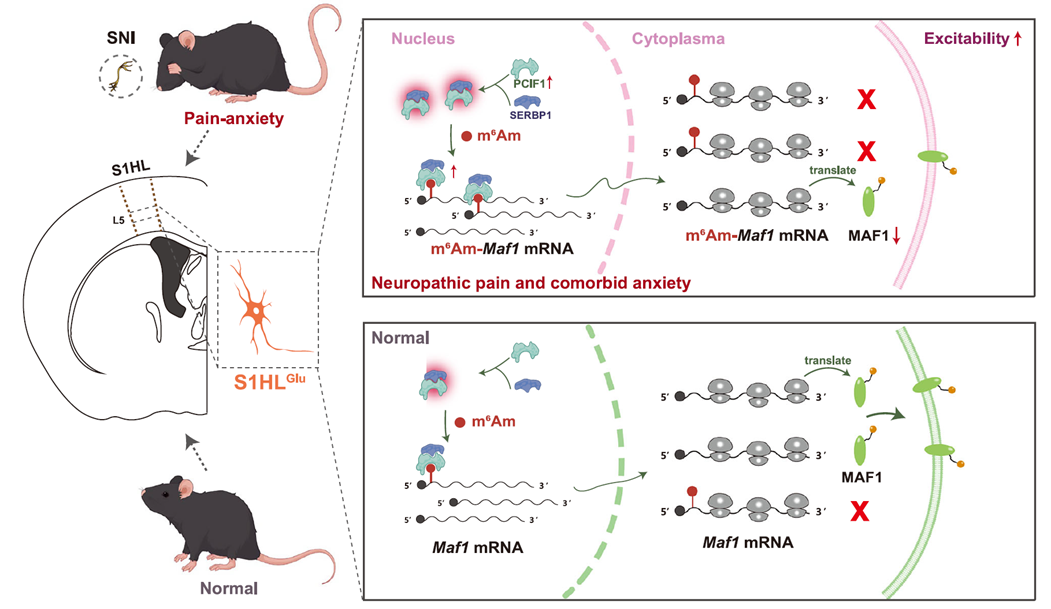 S1HLGlu神經元中的SERBP1-PCIF1復合體如何參與神經性疼痛和并發焦慮的發育與維持