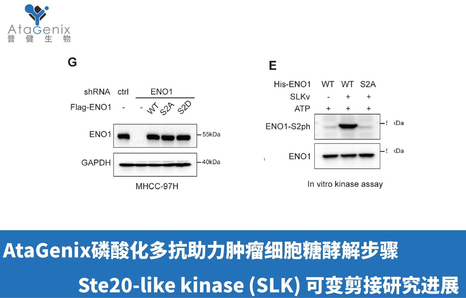 AtaGenix磷酸化多抗助力腫瘤細胞糖酵解步驟Ste20-like kinase (SLK) 可變剪接研究進展