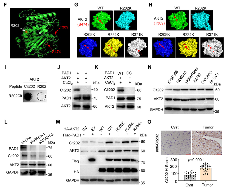  PAD1在R202位點對AKT2的瓜氨酸化促進OC細胞中AKT2酶活性
